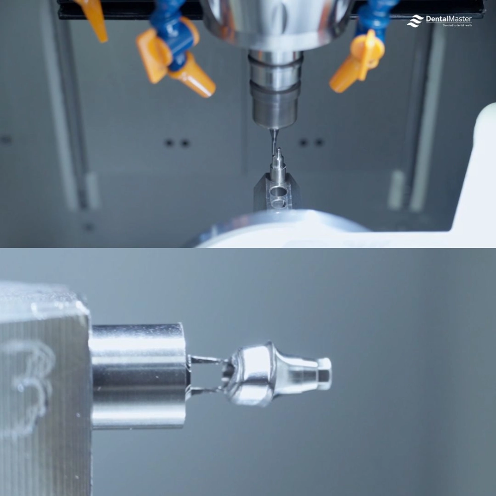 abutments