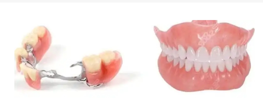 Differences Between Partial Dentures and Complete Dentures