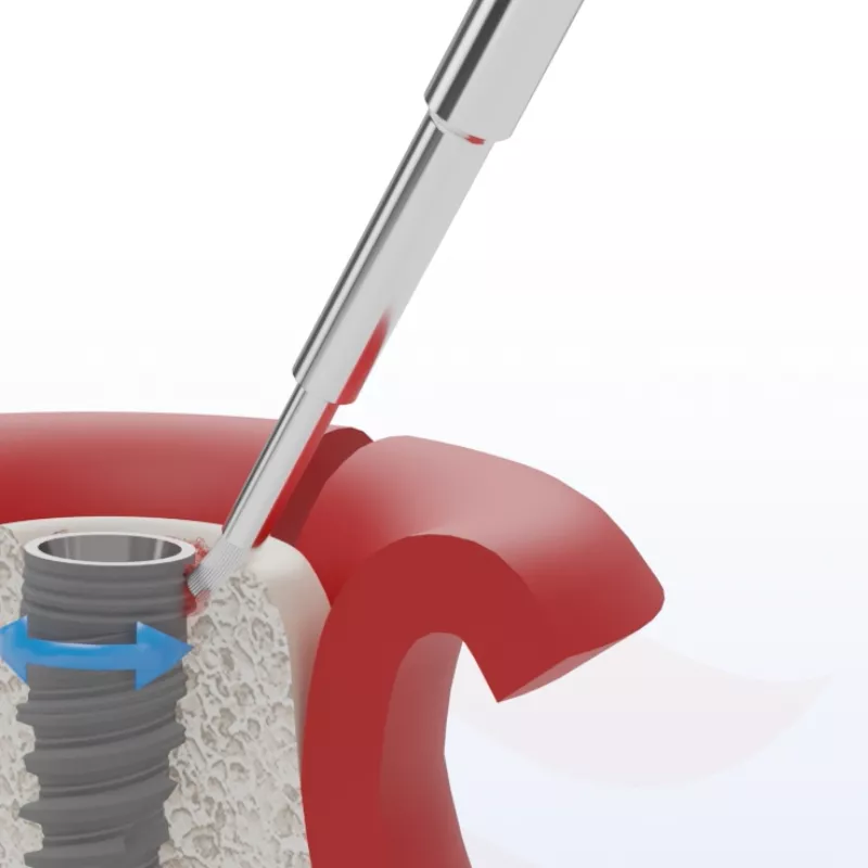 Titanium brush