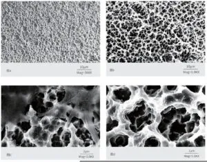 What Is SLA Surface Treatment in Dental Implants?