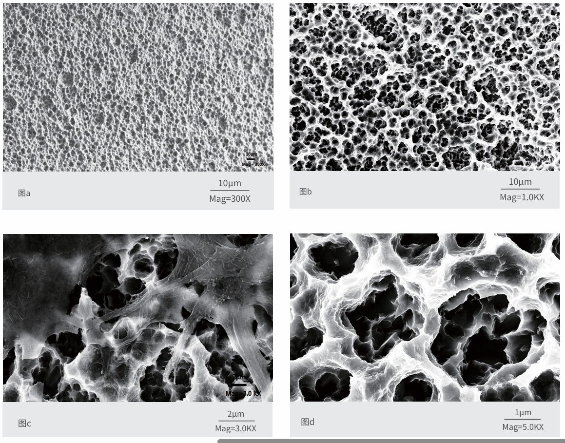 What Is SLA Surface Treatment in Dental Implants?
